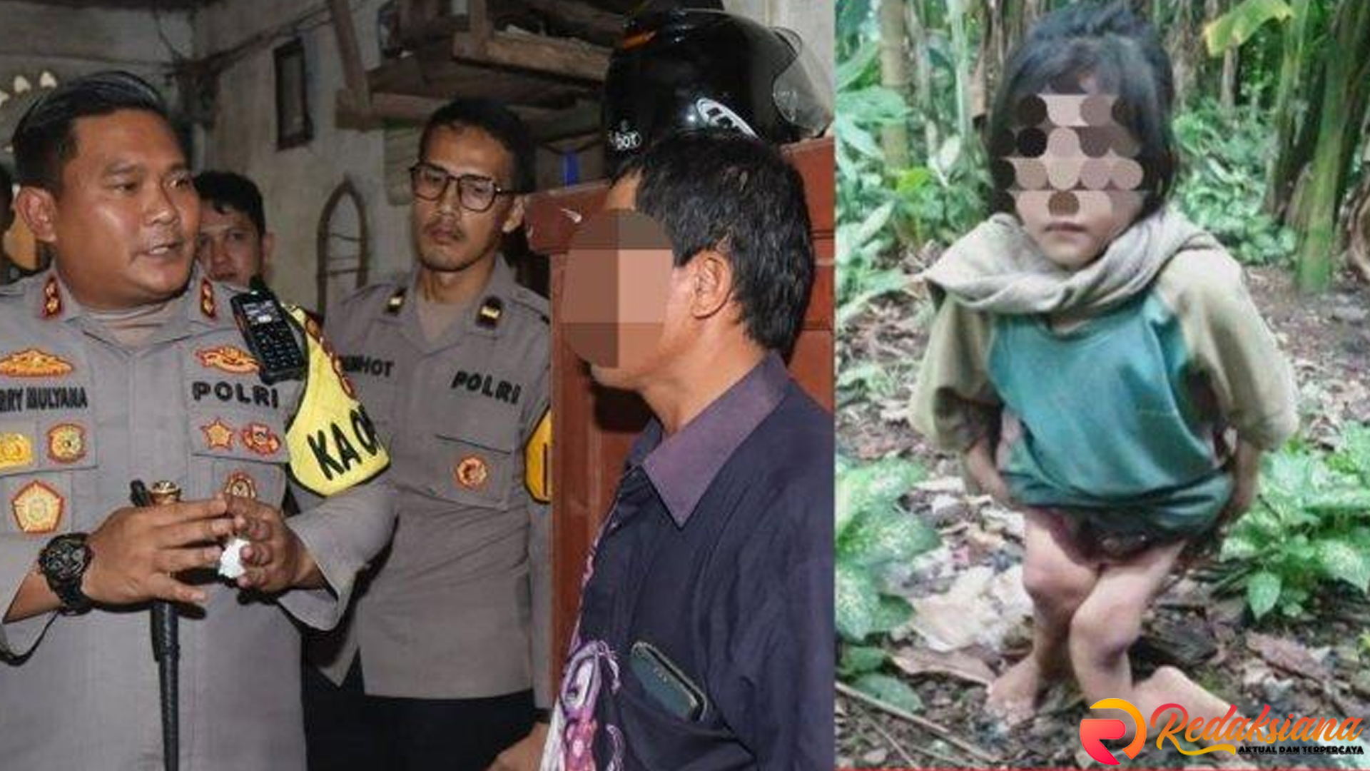 Bocah di Nias Cacat Kaki, Paman Diduga Pelaku Penganiayaan